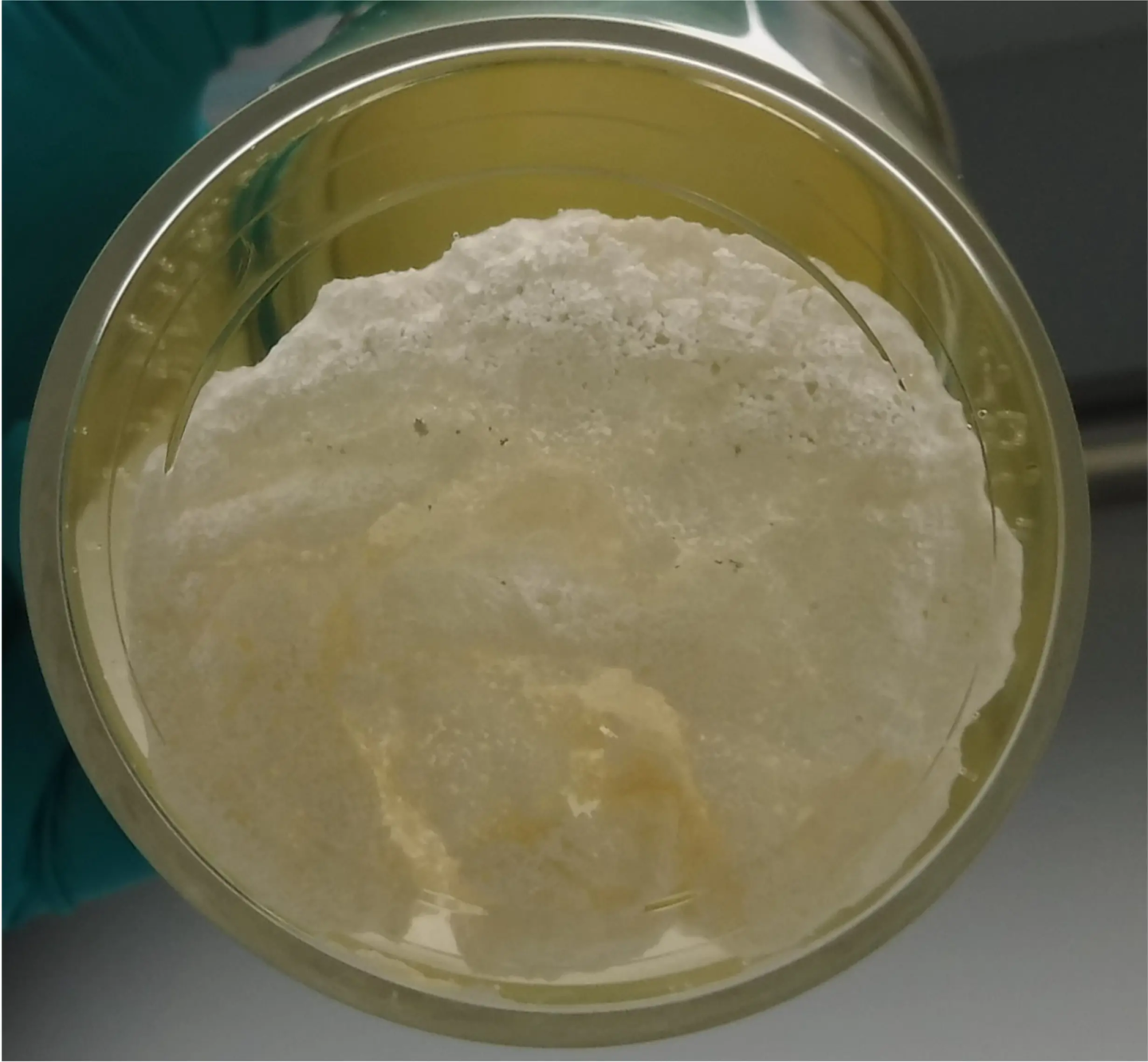 Novadip-NVD003-shipped-ready-for-the-implantation-to-the-patient